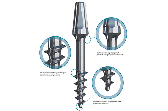 BASAL IMPLANTS